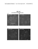 METHODS AND COMPOSITIONS FOR TREATMENT AND DIAGNOSIS OF FIBROSIS, TUMOR     INVASION, ANGIOGENESIS, AND METASTASIS diagram and image