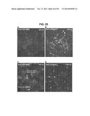 METHODS AND COMPOSITIONS FOR TREATMENT AND DIAGNOSIS OF FIBROSIS, TUMOR     INVASION, ANGIOGENESIS, AND METASTASIS diagram and image