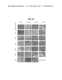 METHODS AND COMPOSITIONS FOR TREATMENT AND DIAGNOSIS OF FIBROSIS, TUMOR     INVASION, ANGIOGENESIS, AND METASTASIS diagram and image