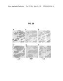 METHODS AND COMPOSITIONS FOR TREATMENT AND DIAGNOSIS OF FIBROSIS, TUMOR     INVASION, ANGIOGENESIS, AND METASTASIS diagram and image