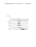 METHODS OF DIAGNOSING AND TREATING AMYOTROPHIC LATERAL SCLEROSIS diagram and image