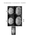 COMPOUNDS AND METHODS FOR TREATING PAIN diagram and image