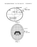 INTENSITY-MODULATED PROTON THERAPY diagram and image