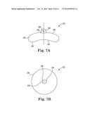 SYSTEM FOR TREATING PELVIC ORGAN PROLAPSE INCLUDING A SHELL AND AN ANCHOR diagram and image