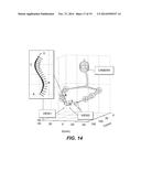 SYSTEMS, DEVICES, AND METHODS FOR PROVIDING INSERTABLE ROBOTIC SENSORY AND     MANIPULATION PLATFORMS FOR SINGLE PORT SURGERY diagram and image