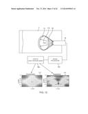 Delivery Of Biological Compounds To Ischemic And/Or Infarcted Tissue diagram and image