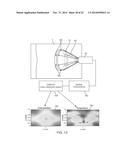 Delivery Of Biological Compounds To Ischemic And/Or Infarcted Tissue diagram and image