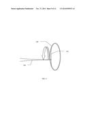 CONTACTLESS PHOTODISRUPTIVE LASER CATARACT SURGERY diagram and image