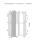 CATHETER WITH MULTIPLE ELECTRODE ASSEMBLIES FOR USE AT OR NEAR TUBULAR     REGIONS OF THE HEART diagram and image