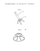 BONE IMPLANTS AND CUTTING APPARATUSES AND METHODS diagram and image