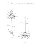 BONE IMPLANTS AND CUTTING APPARATUSES AND METHODS diagram and image