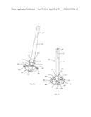 BONE IMPLANTS AND CUTTING APPARATUSES AND METHODS diagram and image