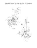 BONE IMPLANTS AND CUTTING APPARATUSES AND METHODS diagram and image