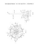 BONE IMPLANTS AND CUTTING APPARATUSES AND METHODS diagram and image