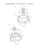 BONE IMPLANTS AND CUTTING APPARATUSES AND METHODS diagram and image