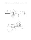 BONE IMPLANTS AND CUTTING APPARATUSES AND METHODS diagram and image