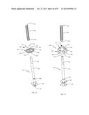 BONE IMPLANTS AND CUTTING APPARATUSES AND METHODS diagram and image