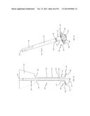 BONE IMPLANTS AND CUTTING APPARATUSES AND METHODS diagram and image