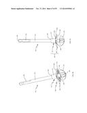 BONE IMPLANTS AND CUTTING APPARATUSES AND METHODS diagram and image