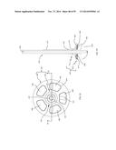 BONE IMPLANTS AND CUTTING APPARATUSES AND METHODS diagram and image