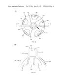 BONE IMPLANTS AND CUTTING APPARATUSES AND METHODS diagram and image