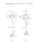 BONE IMPLANTS AND CUTTING APPARATUSES AND METHODS diagram and image