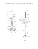 BONE IMPLANTS AND CUTTING APPARATUSES AND METHODS diagram and image