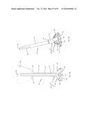 BONE IMPLANTS AND CUTTING APPARATUSES AND METHODS diagram and image