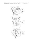 HAIR REMOVAL SHEET diagram and image