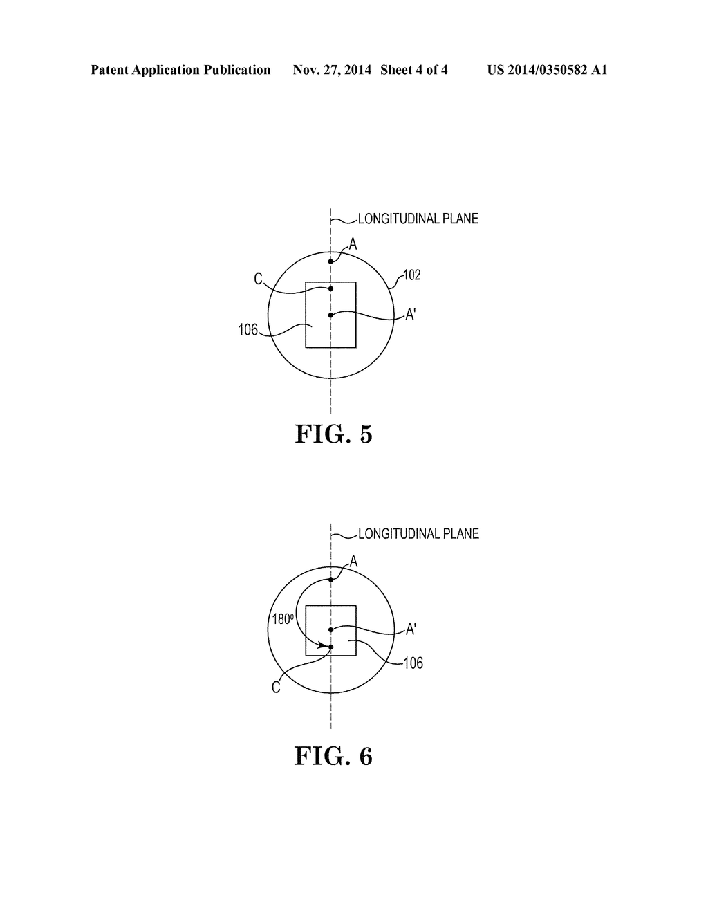 DEVICES, SYSTEMS AND METHODS FOR AN OSCILLATING CROWN DRIVE FOR ROTATIONAL     ATHERECTOMY - diagram, schematic, and image 05