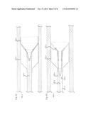 STENT AND OTHER OBJECT REMOVAL FROM A BODY diagram and image