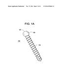 Systems and Methods for Manipulating and/or Installing Title of Invention     a Pedical Screw diagram and image