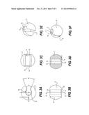 CROSS PIN FIXATOR FOR BONE FRAGMENTS AND USE THEREOF diagram and image