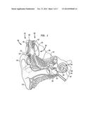 Implantable Medical Device and Tool Sensors diagram and image