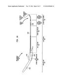 Implantable Medical Device and Tool Sensors diagram and image