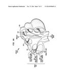 Implantable Medical Device and Tool Sensors diagram and image