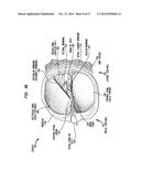 Implantable Medical Device and Tool Sensors diagram and image