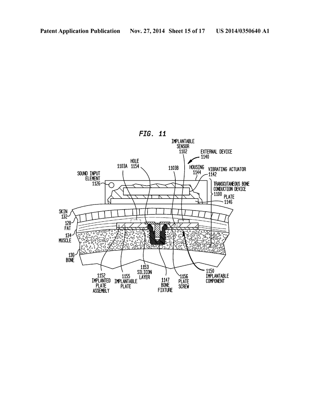 Implantable Medical Device and Tool Sensors - diagram, schematic, and image 16