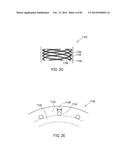 GROUNDING OF A SHIELD WITHIN AN IMPLANTABLE MEDICAL LEAD diagram and image