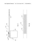 GROUNDING OF A SHIELD WITHIN AN IMPLANTABLE MEDICAL LEAD diagram and image