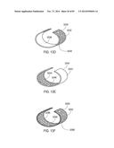 GROUNDING OF A SHIELD WITHIN AN IMPLANTABLE MEDICAL LEAD diagram and image