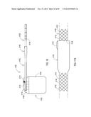 GROUNDING OF A SHIELD WITHIN AN IMPLANTABLE MEDICAL LEAD diagram and image