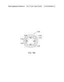 GROUNDING OF A SHIELD WITHIN AN IMPLANTABLE MEDICAL LEAD diagram and image