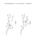 GROUNDING OF A SHIELD WITHIN AN IMPLANTABLE MEDICAL LEAD diagram and image