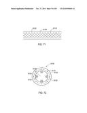 GROUNDING OF A SHIELD WITHIN AN IMPLANTABLE MEDICAL LEAD diagram and image