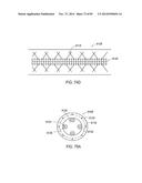 GROUNDING OF A SHIELD WITHIN AN IMPLANTABLE MEDICAL LEAD diagram and image