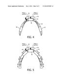 MOUTHPIECE FOR CLEANING TEETH WITH AN ADJUSTABLE ARC LENGTH AND/OR ARC     WIDTH diagram and image
