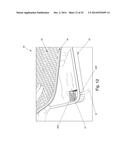 Extremity Surgical Support Debridement Platform diagram and image