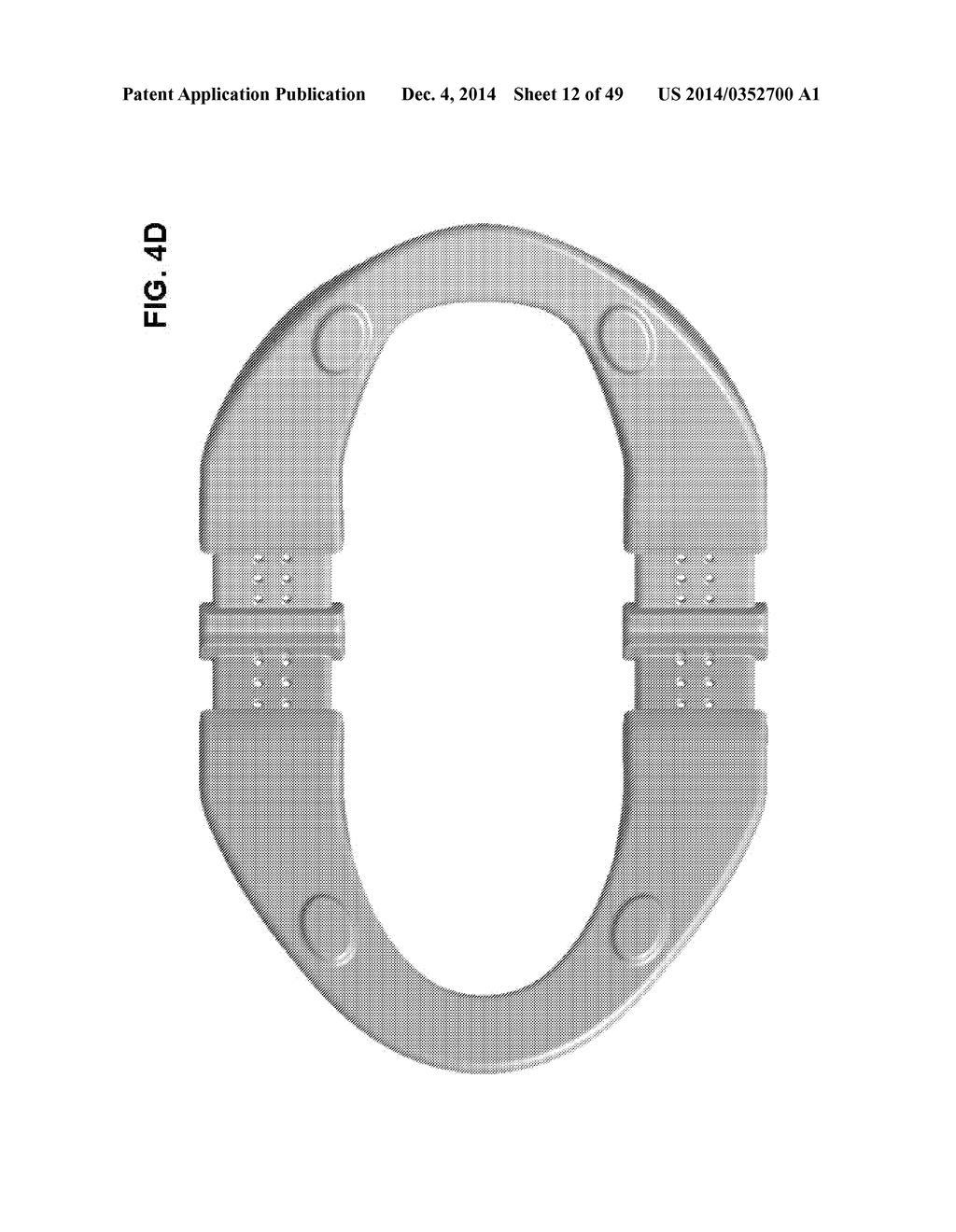 INCREMENTAL AND/OR SUCCESSIVE ADJUSTABLE MANDIBULAR ADVANCEMENT DEVICE FOR     PREVENTING AND TREATMENT OF SNORING AND OBSTRUCTIVE SLEEP APNEA - diagram, schematic, and image 13