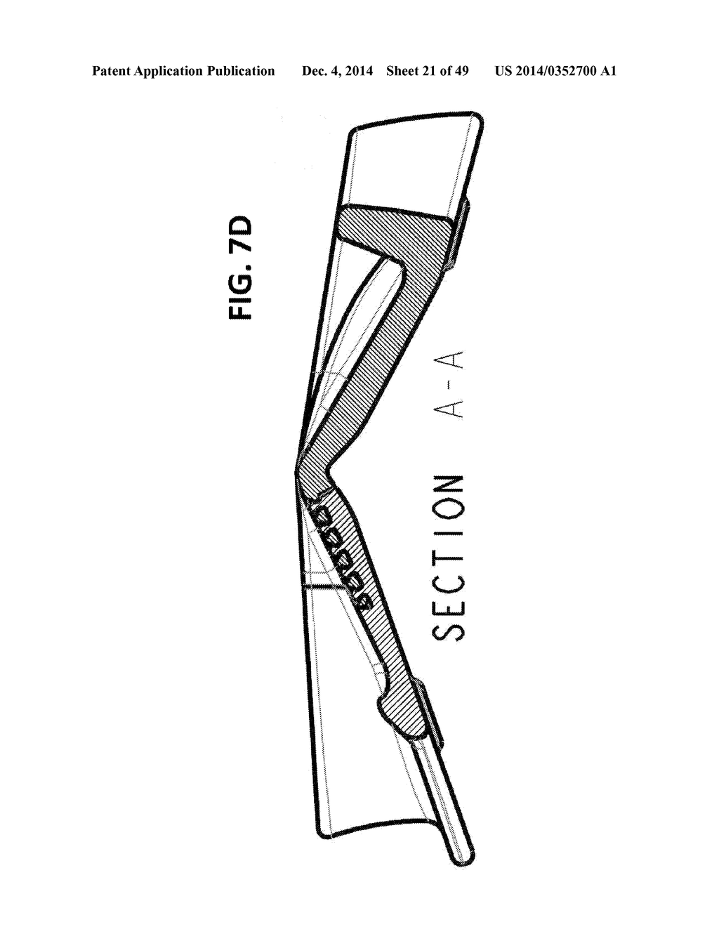 INCREMENTAL AND/OR SUCCESSIVE ADJUSTABLE MANDIBULAR ADVANCEMENT DEVICE FOR     PREVENTING AND TREATMENT OF SNORING AND OBSTRUCTIVE SLEEP APNEA - diagram, schematic, and image 22